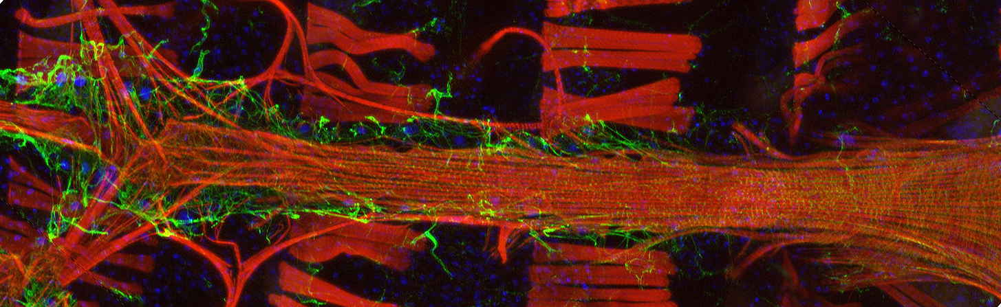 Drosophila Fly Heart